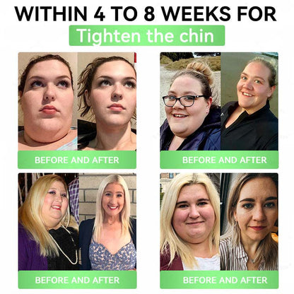 Official Store🧑‍⚕️| Alcuras™ Moringa × Berberine × AMPK 8-Benefit Slimming & Metabolic Nano Microneedle Patch 🇺🇸  Just once a day · Visible changes in 7 days  ✅ For obesity, loose skin, diabetes, sleep apnea, joint issues, and more